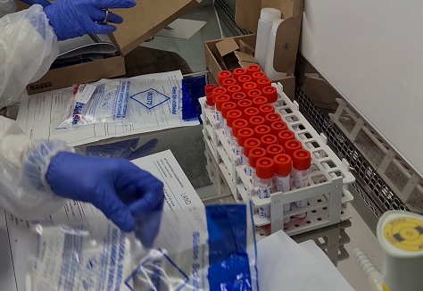 Organisation der Massentests l&auml;uft auf Hochtouren