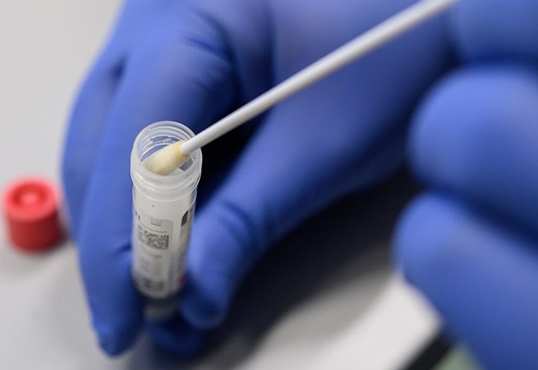 Massentests Anmeldung ab sofort m&ouml;glich